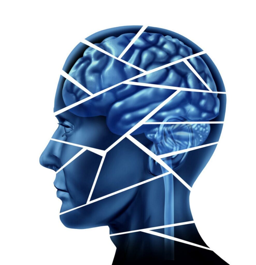 Blue head silhouette with brain broken into pieces representing brain injury
