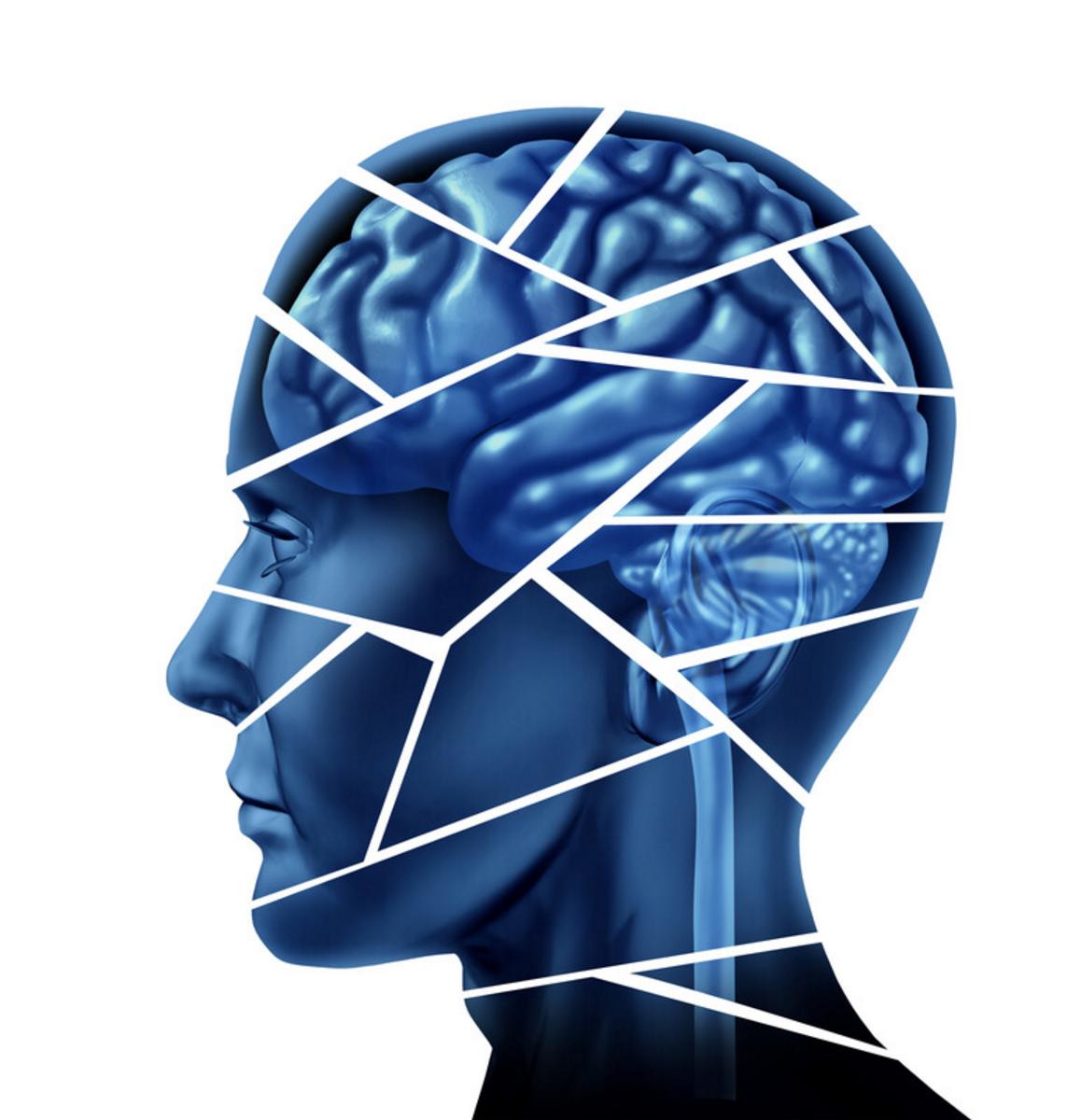 Blue head image with brain outline, cut into pieces representing brain injury